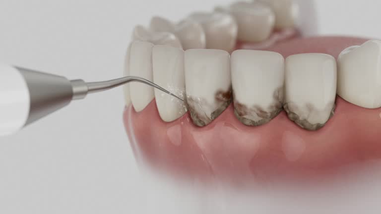 Trusted Tooth Extraction service in Glen Lyon, PA - Dentist Open Now